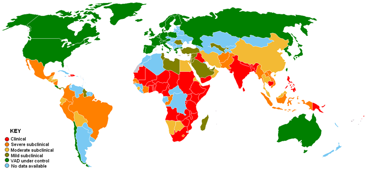 vitamin a deficiency worldwide