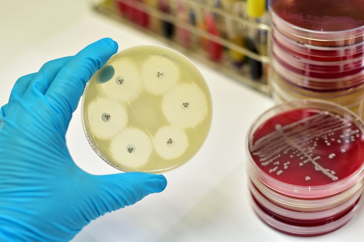 Petri Dish